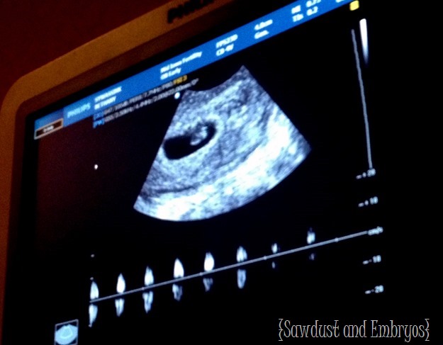 Baby Sy... 6 weeks gestation {Sawdust and Embryos}